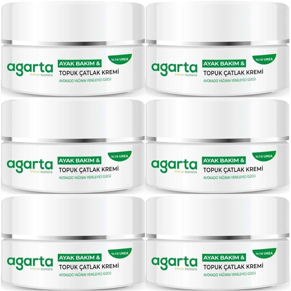 Agarta Ayak ve Topuk Çatlak Bakım Kremi 100ML (6 Lı Set)