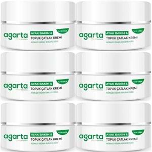 Agarta Ayak ve Topuk Çatlak Bakım Kremi 100ML (6 Lı Set)